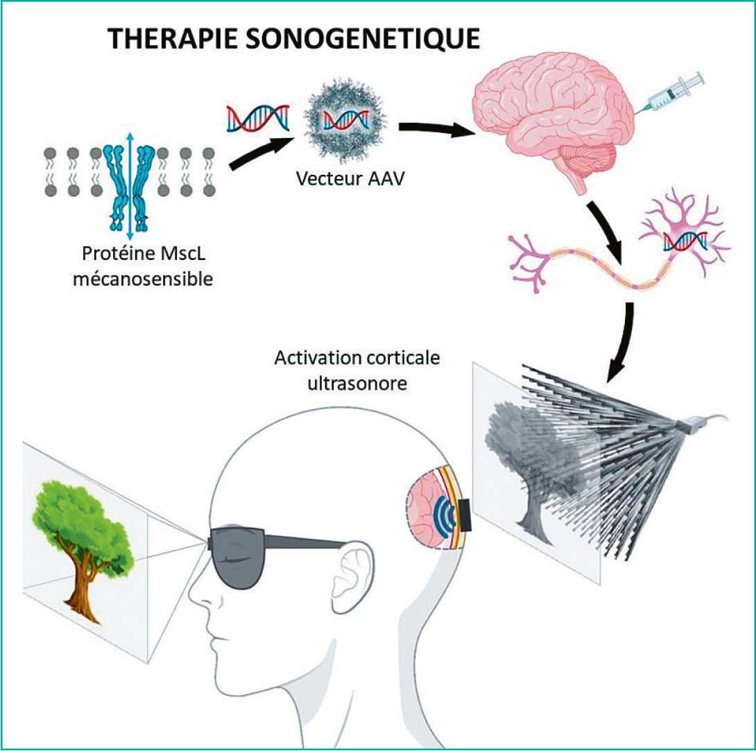 therapie-sonogenetique